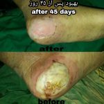 IMG_20200807_200438_466