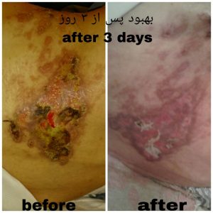 IMG_20200807_200423_028