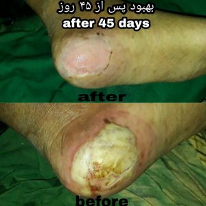 IMG_20200807_200438_466