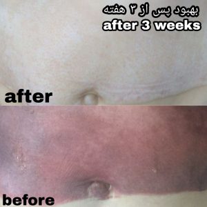 IMG_20200807_200508_069