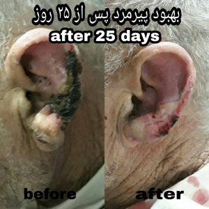 IMG_20200807_200512_283