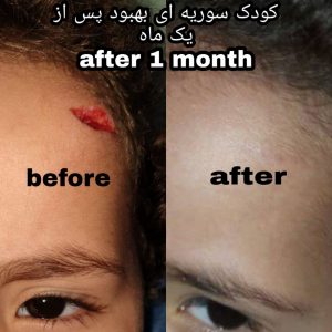 IMG_20200807_200515_553